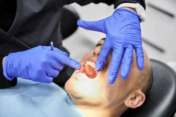 Best Emergency Gum Treatment in Lakewood, IL